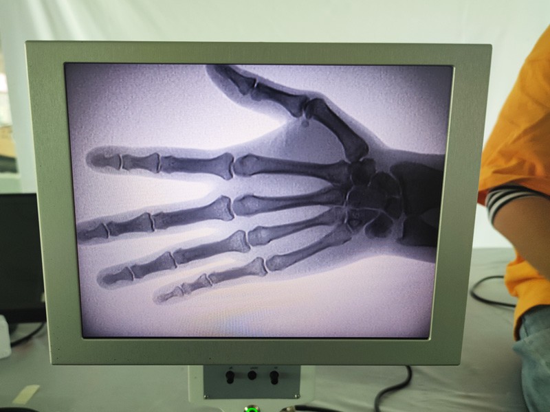 Real time imaging X-ray machine Real time imaging X-ray machine